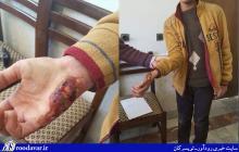 حمله سگ های ولگرد به یک نوجوان سرکانی/معظلی به نام تعدد سگ های ولگرد در یک شهر 