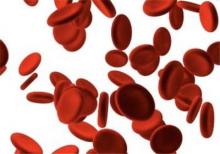 مرگ‌های غیرناگهانی به دلیل «لختگی خون»/هشدار به پشت‌میزنشین‌ها و چاق‌ها