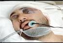 اعضای بدن شاهسوندی،‌ اسکی‌باز به کما رفته کشورمان اهدا شد